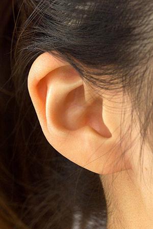 ヘアーアレンジ無料の医療用ウィッグ